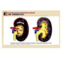 Рельефная таблица "Почка. Фронтальный разрез" (формат А1, матовое ламинир.) - «globural.ru» - Тихорецк